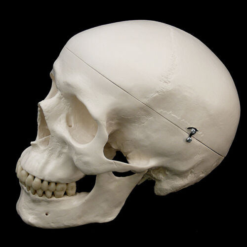 Cranio di Hugo
